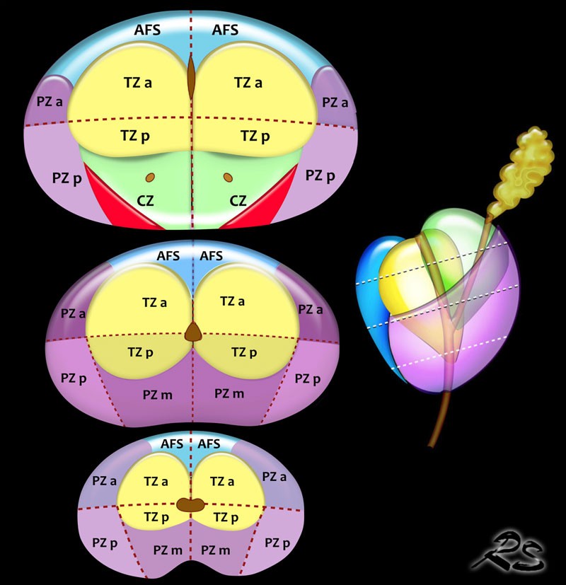 PI-RADS v2.1 prostate sector map: 38-sector diagram of the peripheral zone, transition zone, anterior fibromuscular stroma and seminal vesicles across the base, mid-gland and apex, used to localize prostate MRI lesions for structured reporting