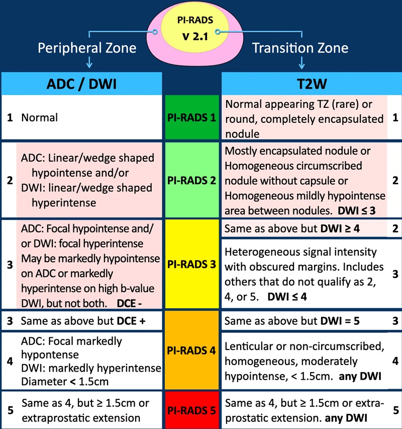 PI-RADS v2.1 assessment summary table mapping peripheral zone ADC/DWI categories and transition zone T2W categories to PI-RADS scores 1 through 5